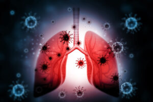 Lungs disease with virus ,bacteria